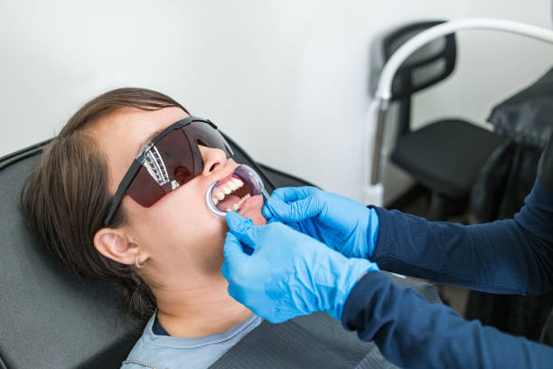 Best Emergency Dental Care for Broken or Chipped Teeth in Folsom, CA